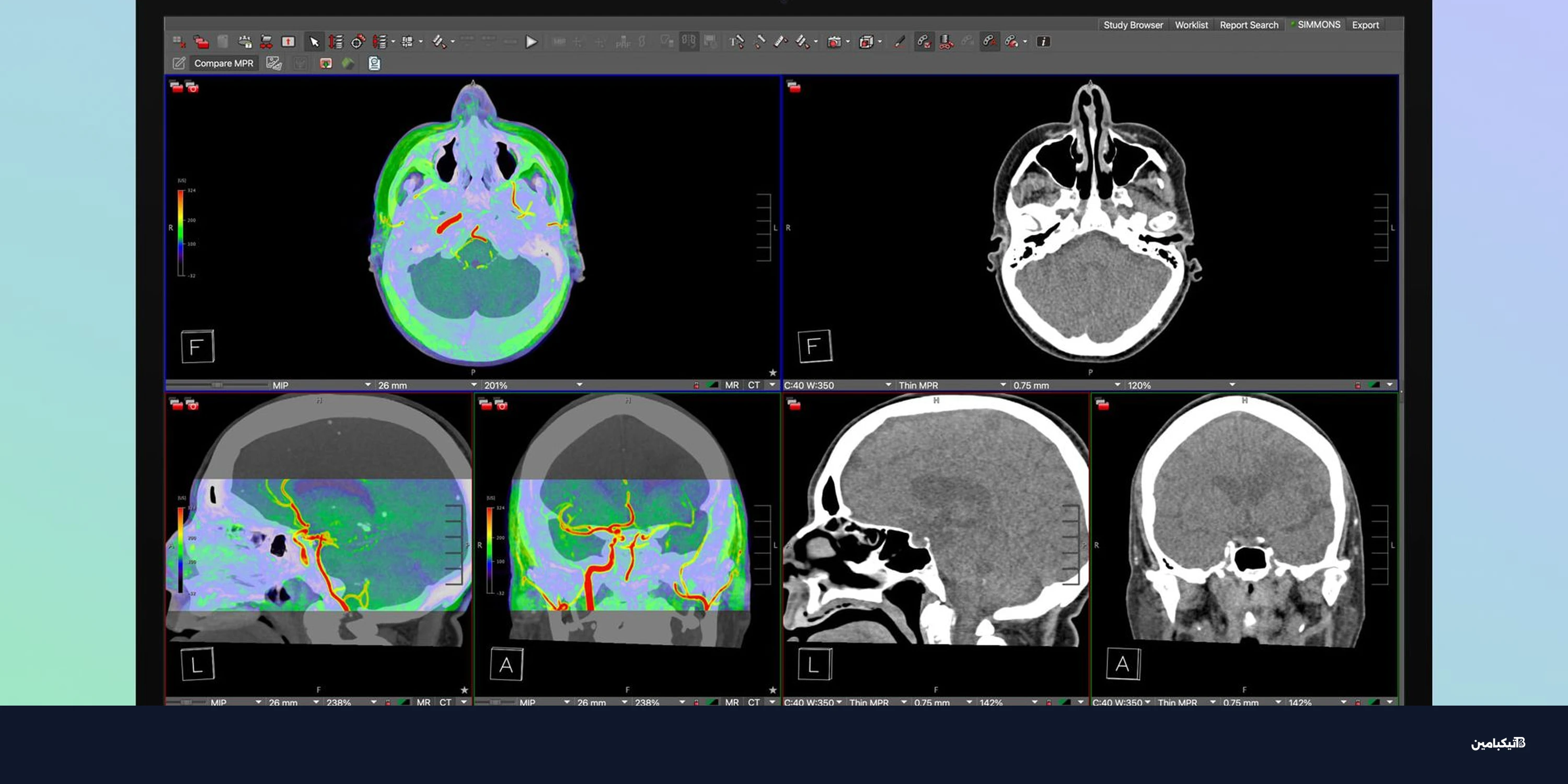 مواصفات شاشة آبل Studio Display XDR للتصوير الطبي