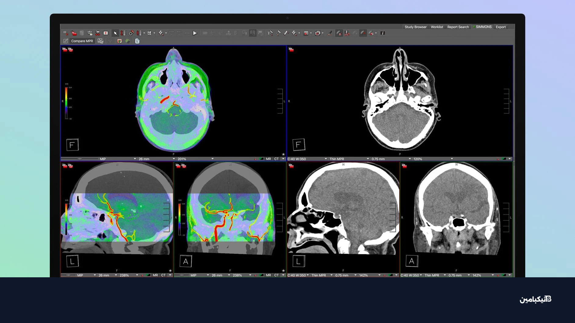 studio display xdr medical presets
